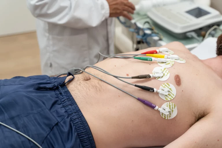 Devi fare il certificato medico sportivo? Fai l’ECG in Farmacie Azzuoli
